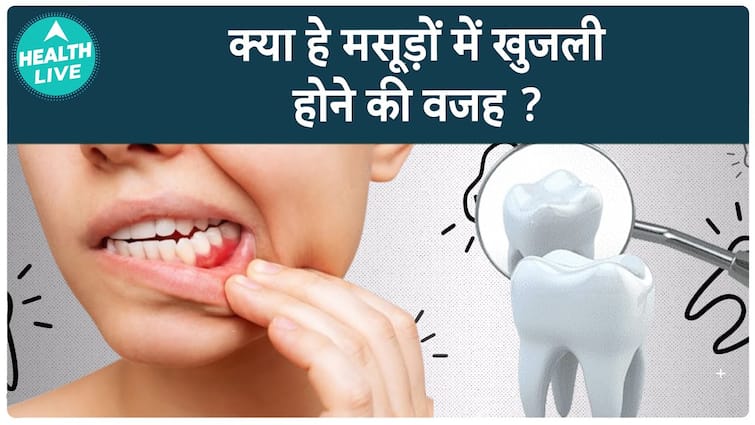 आपके मसूड़ों में खुजली क्यों होती है? सामान्य कारणों को समझें | हेल्थ लाइव