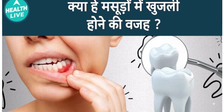 आपके मसूड़ों में खुजली क्यों होती है? सामान्य कारणों को समझें | हेल्थ लाइव