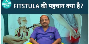 फिस्टुला गठन को समझना: यह कैसे शुरू होता है, कारण, और आपको क्या जानना चाहिए | हेल्थ लाइव