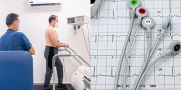 ECG के लिए व्यायाम तनाव परीक्षण: 7 परीक्षण आपके दिल के स्वास्थ्य की जांच करने के लिए