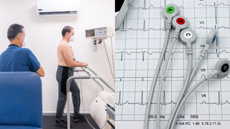 ECG के लिए व्यायाम तनाव परीक्षण: 7 परीक्षण आपके दिल के स्वास्थ्य की जांच करने के लिए