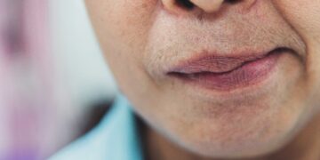 बेल का पक्षाघात क्या है? इस बीमारी के बारे में कारण, लक्षण, उपचार और अधिक जानें