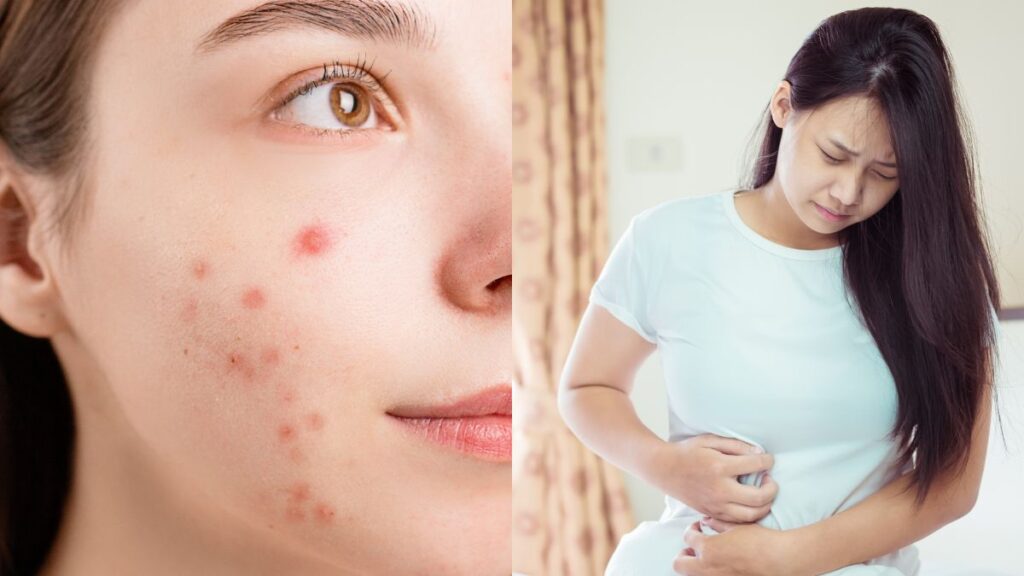 पाचन समस्याओं के लिए मुँहासे: उच्च तनाव के स्तर के असामान्य संकेत जिन्हें आपको ध्यान देना चाहिए