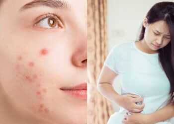 पाचन समस्याओं के लिए मुँहासे: उच्च तनाव के स्तर के असामान्य संकेत जिन्हें आपको ध्यान देना चाहिए