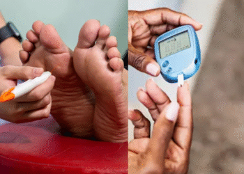 डायबिटिक न्यूरोपैथी क्या है और यह खतरनाक क्यों है? एम्स विशेषज्ञ आपको क्या करना चाहिए, इस बारे में बताता है