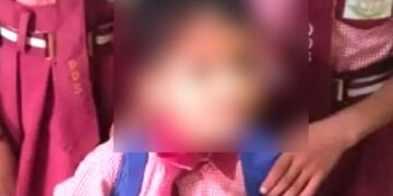 प्रयाग्राज समाचार: चौंकाने वाला! शिक्षक थप्पड़ मारता है 3 साल का, लड़का मर जाता है