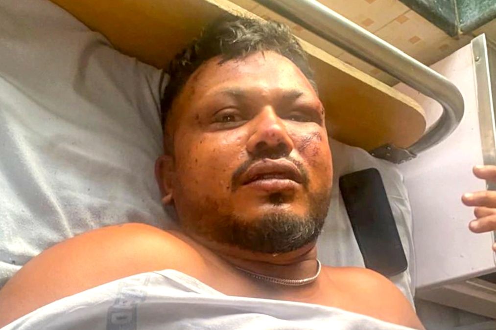 अहमदाबाद विमान दुर्घटना: 'मुज्हे लागा माई भी मार्ने वला हून' लोन सर्वाइवर विश्वस कुमार पर मौत से बचें