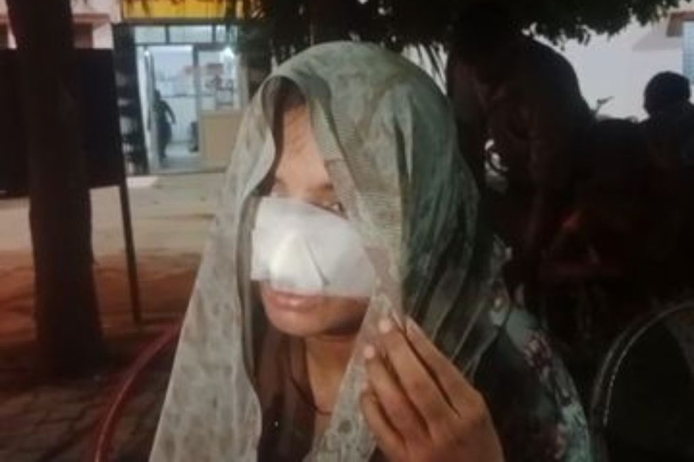 हार्डोई न्यूज: मैन ने पत्नी की नाक को अपना संबंध खोजने के बाद, लोग सोशल मीडिया पर प्रतिक्रिया करते हैं