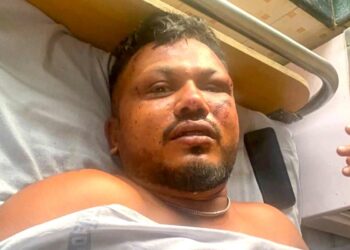 अहमदाबाद विमान दुर्घटना: 'मुज्हे लागा माई भी मार्ने वला हून' लोन सर्वाइवर विश्वस कुमार पर मौत से बचें