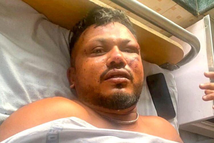 अहमदाबाद विमान दुर्घटना: 'मुज्हे लागा माई भी मार्ने वला हून' लोन सर्वाइवर विश्वस कुमार पर मौत से बचें