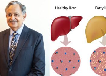 क्या फैटी लीवर का परिणाम सिरोसिस में हो सकता है? प्रगति से बचने के लिए विशेषज्ञ की राय की जाँच करें