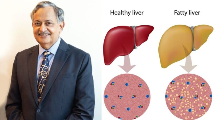 क्या फैटी लीवर का परिणाम सिरोसिस में हो सकता है? प्रगति से बचने के लिए विशेषज्ञ की राय की जाँच करें