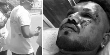 यात्री सीट 11 ए से बचने के लिए क्यों जाते हैं? अहमदाबाद विमान दुर्घटना उत्तरजीवी की मृत्यु!