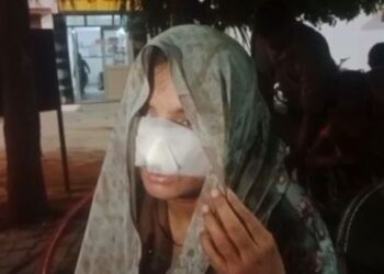 हार्डोई न्यूज: मैन ने पत्नी की नाक को अपना संबंध खोजने के बाद, लोग सोशल मीडिया पर प्रतिक्रिया करते हैं